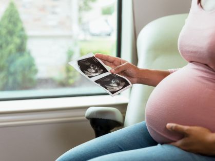 Bild: Schwangere mit Ultraschallbild in der Hand